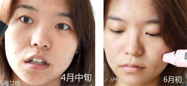 自然之名酵母水安全吗