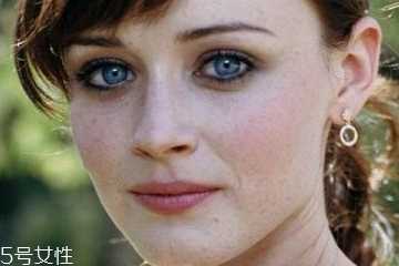 皮秒会不会留疤 皮秒会不会留疤