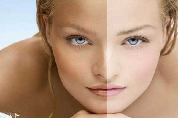 如何美白祛斑 如何祛斑美白的小窍门妙招
