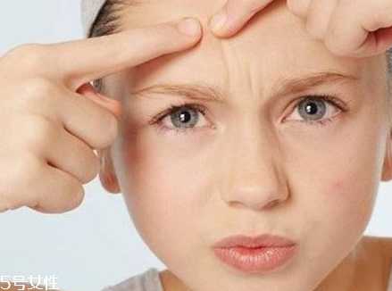 额头上长痘痘怎么办？额头上长痘痘的原因