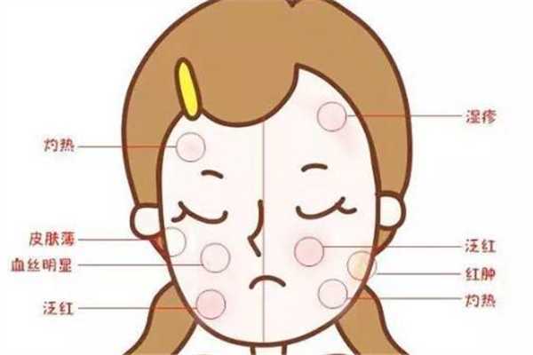 敏感肌可以用芦荟胶吗？敏感肌适合什么成分的护肤品