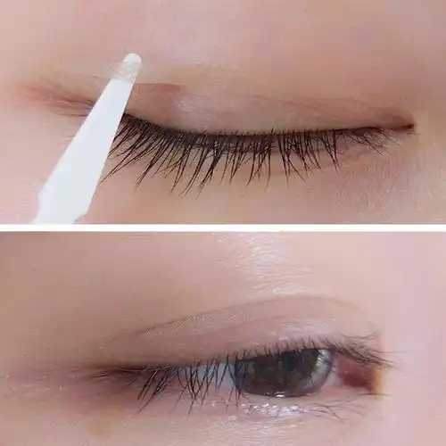 双眼皮贴的正确贴法