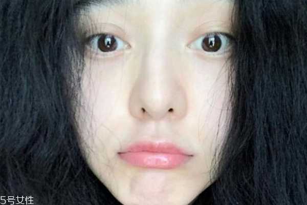 敏感肌怎么变好