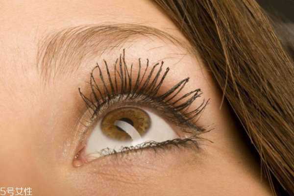 天生泪沟怎么消除 消除眼部泪沟并不难