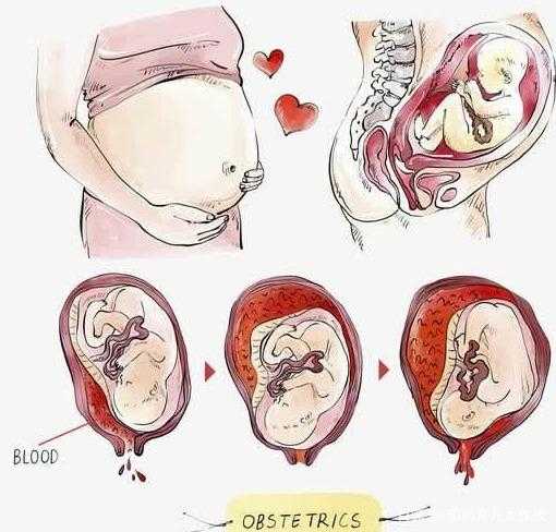 怀孕是什么 怀孕是什么