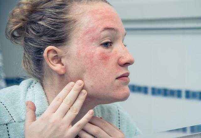 敏感肌怎么判断?敏感肌肤修复方法 敏感肌怎么判断?敏感肌肤修复方法