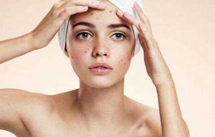 痘痘挤出来的白色东西是什么？痘痘挤破了出血怎么办