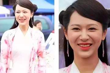 法令纹明显什么原因