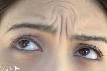 两眉中间要涂眼霜吗？两眉中间川字纹怎么按摩