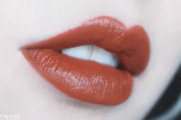 脏橘色适合黄皮吗？