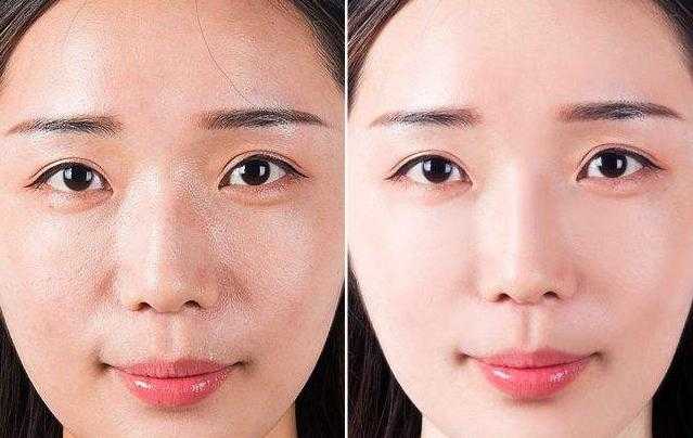 控油是不是去油的意思?怎样面部控油最有效 控油是不是去油的意思?怎样面部控油最有效