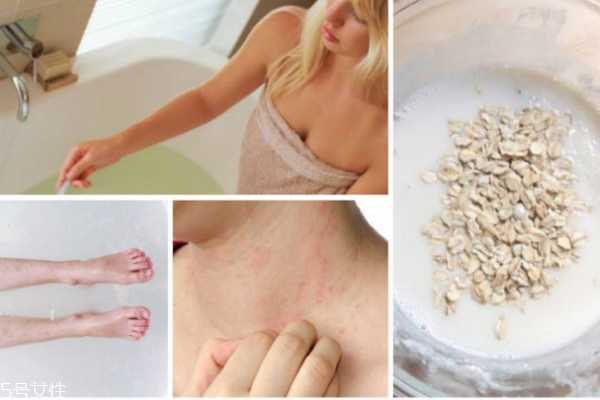 皮肤干痒起皮怎么办