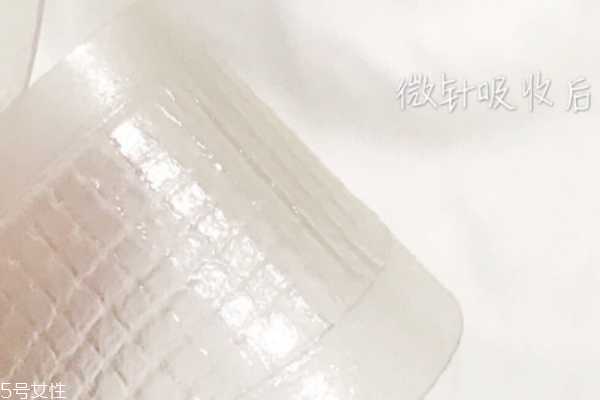 艾派丝微针怎么样 艾派丝微针眼膜能过夜吗