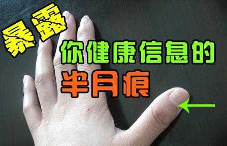 指甲上的半月痕你懂多少？指甲半月痕与健康吉凶关系