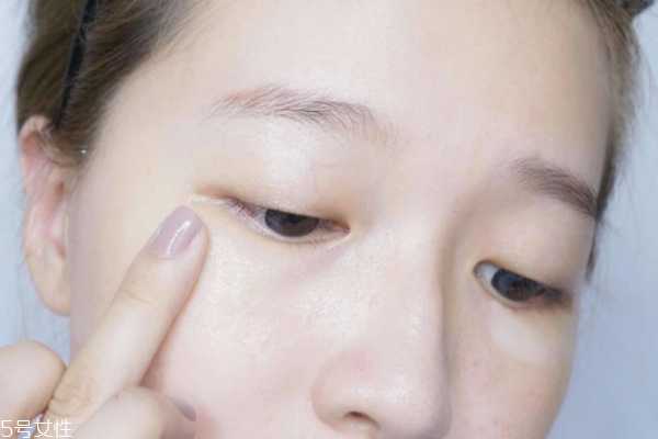 熊猫眼怎么消退快速