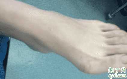 拇外翻矫正器有效果吗？拇外翻矫正器一天带多长时间