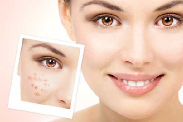 娇韵诗美白精华适合什么皮肤 娇韵诗美白精华适合什么皮肤