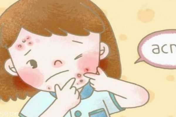 敷尔佳敷完要不要洗脸