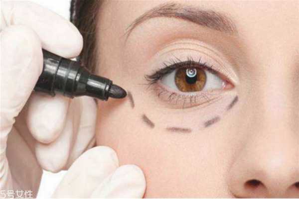 黑眼圈和眼袋有什么区别 黑眼圈和眼袋的区别