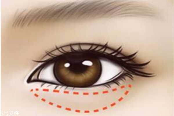 去除鱼尾纹眼袋的妙方