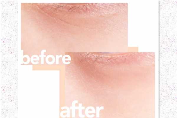 兰蔻小黑瓶是什么功效