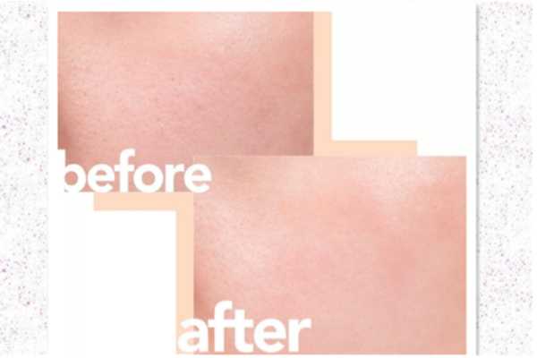 兰蔻小黑瓶是什么功效