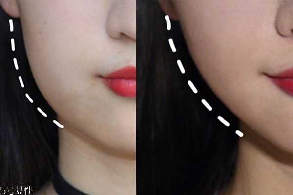 早上脸部水肿怎么消除