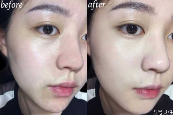 鼻子卡粉什么原因？鼻子周围卡粉怎么回事