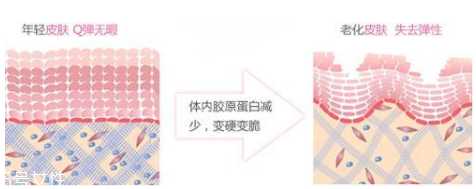 油性皮肤怎么抗氧化