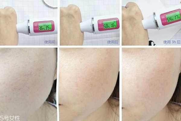 瑞铂希精华素好用吗