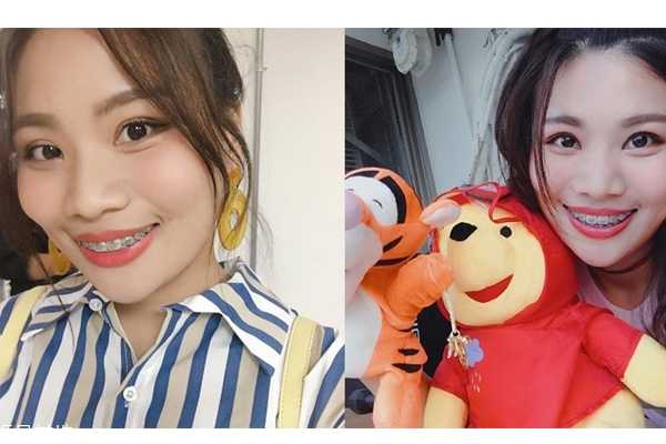 国字脸怎么瘦脸