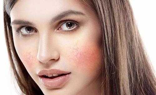 敏感肌怎么判断?敏感肌肤修复方法 敏感肌怎么判断?敏感肌肤修复方法