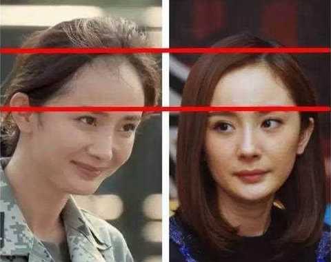 怎么解决发际线后移？发际线后移我们该如何挽救