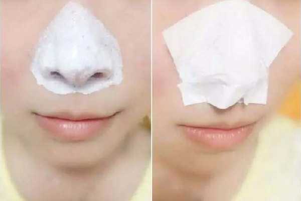 去黑头可以用水杨酸吗 去黑头可以用水杨酸吗