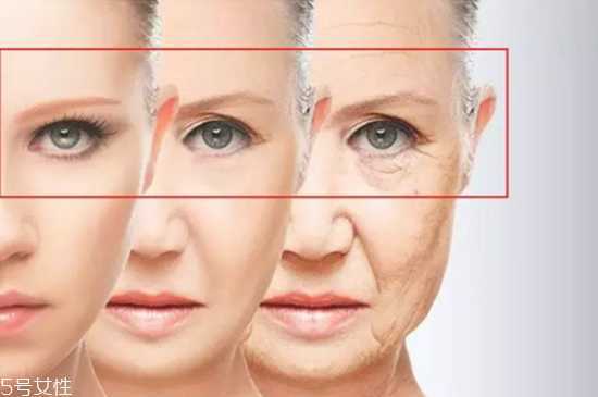 鱼尾纹贴眼膜有用吗 去眼部皱纹最好的眼膜