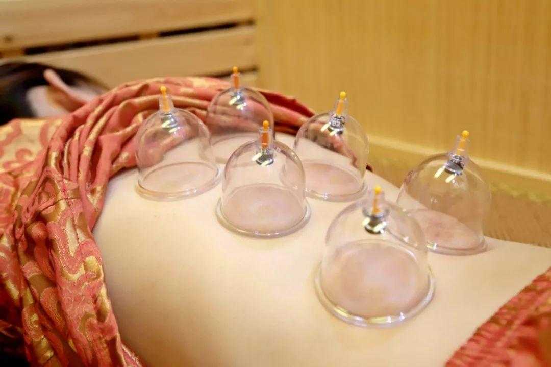 拔罐后多长时间可以洗澡