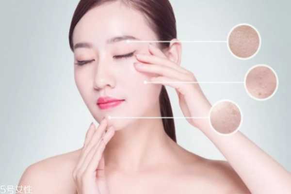 什么皮肤需要去角质 深层清洁不是所有人都适合