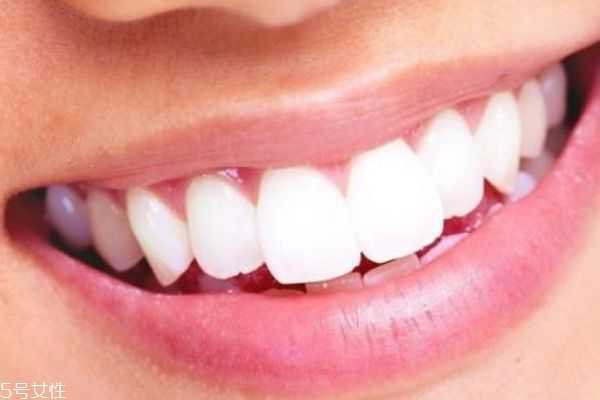 牙贴会损坏牙齿吗 牙贴会损坏牙齿吗