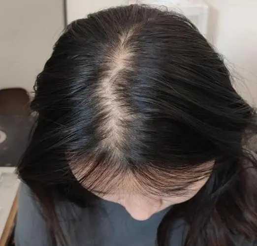 头发少，怎么发量怎么变多