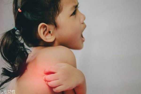 冬季瘙痒症多久才会好