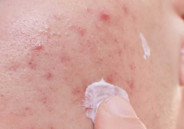 珍珠粉的功效有哪些 珍珠粉的功效有哪些