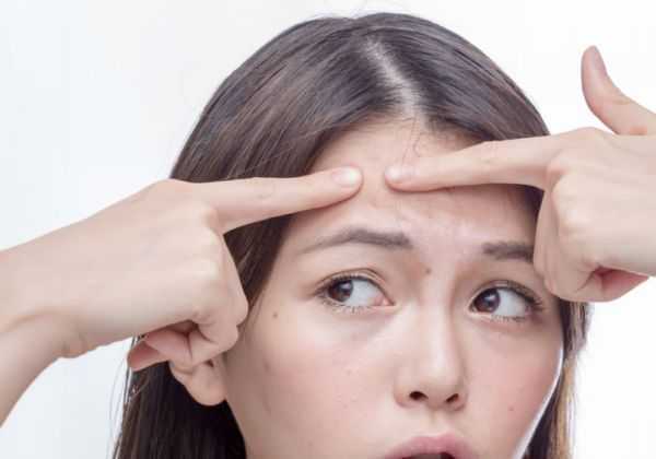 粉刺是怎么形成的 粉刺是怎么形成的