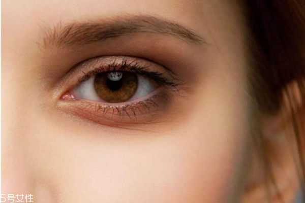 眼纹是怎么形成的