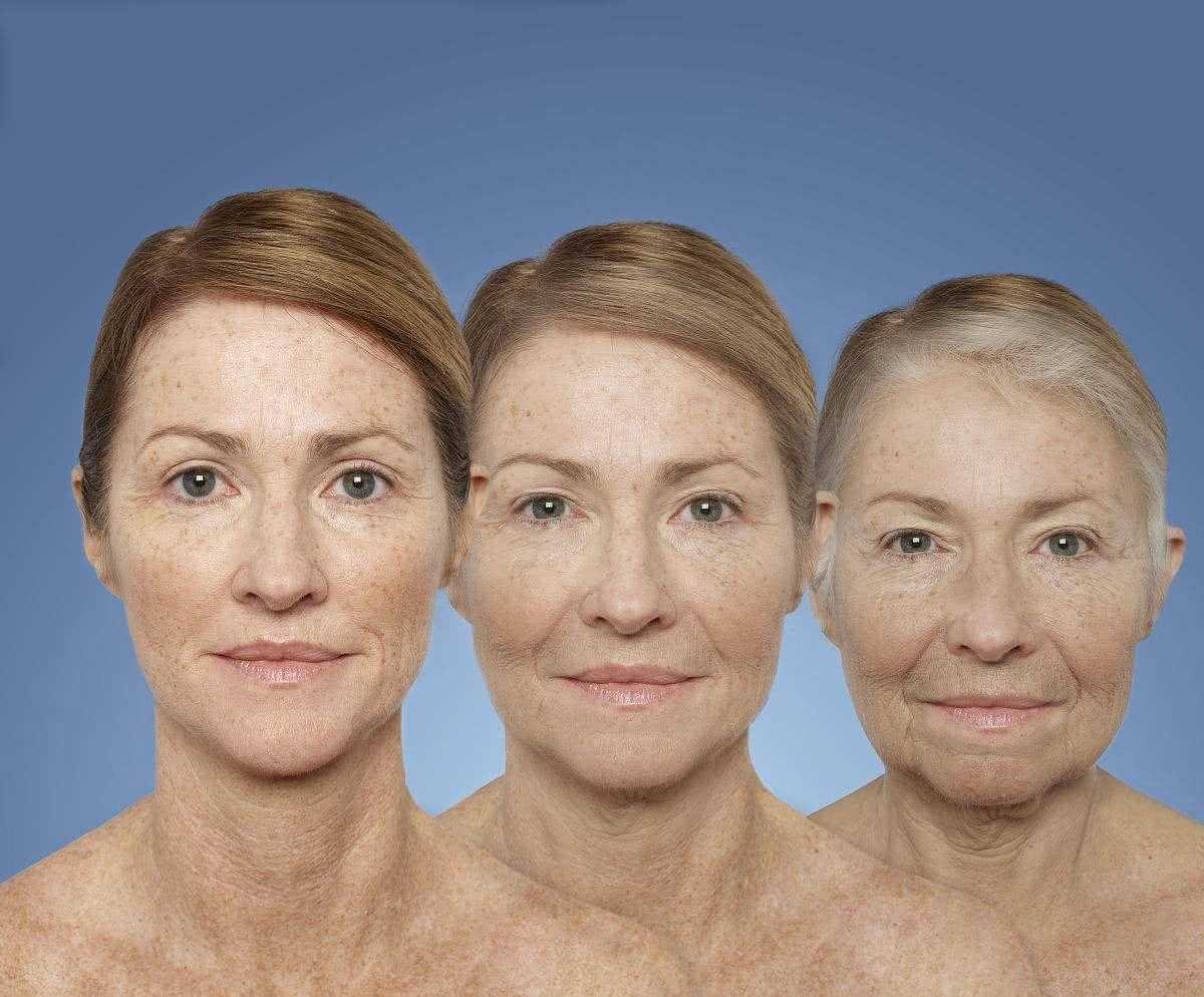 皮肤氧化是什么意思 皮肤氧化了怎么修复