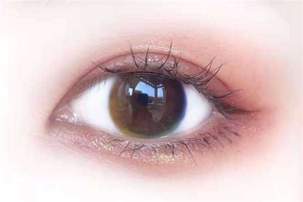 美瞳过期了还能继续戴吗 美瞳过期了还能继续戴吗