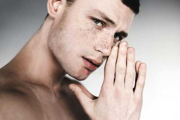 男生为什么会长雀斑？男生长雀斑的原因