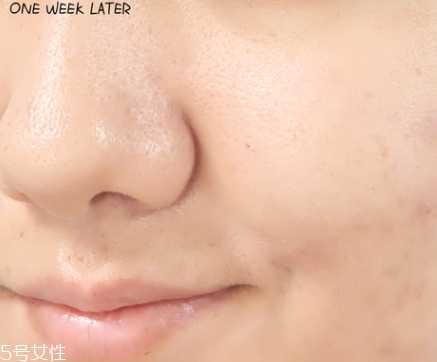 悦诗风吟小白管怎么用 悦诗风吟小白管怎么用