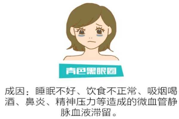 如何分辨黑眼圈类型