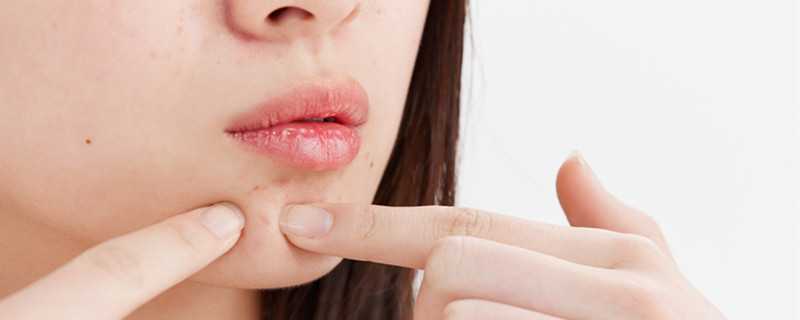 生姜擦脸可以祛痘吗 生姜擦脸可以祛痘吗