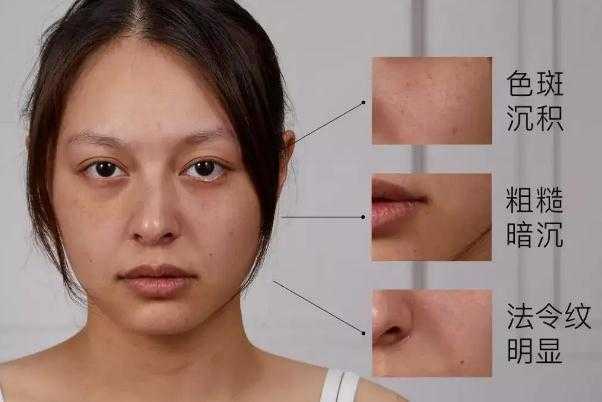 皮肤暗黄有斑怎么调理能变白？皮肤暗黄是身体哪里出了问题